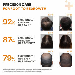 Hair regrowth serum roll on Dermasys for thinning hair and hair loss control