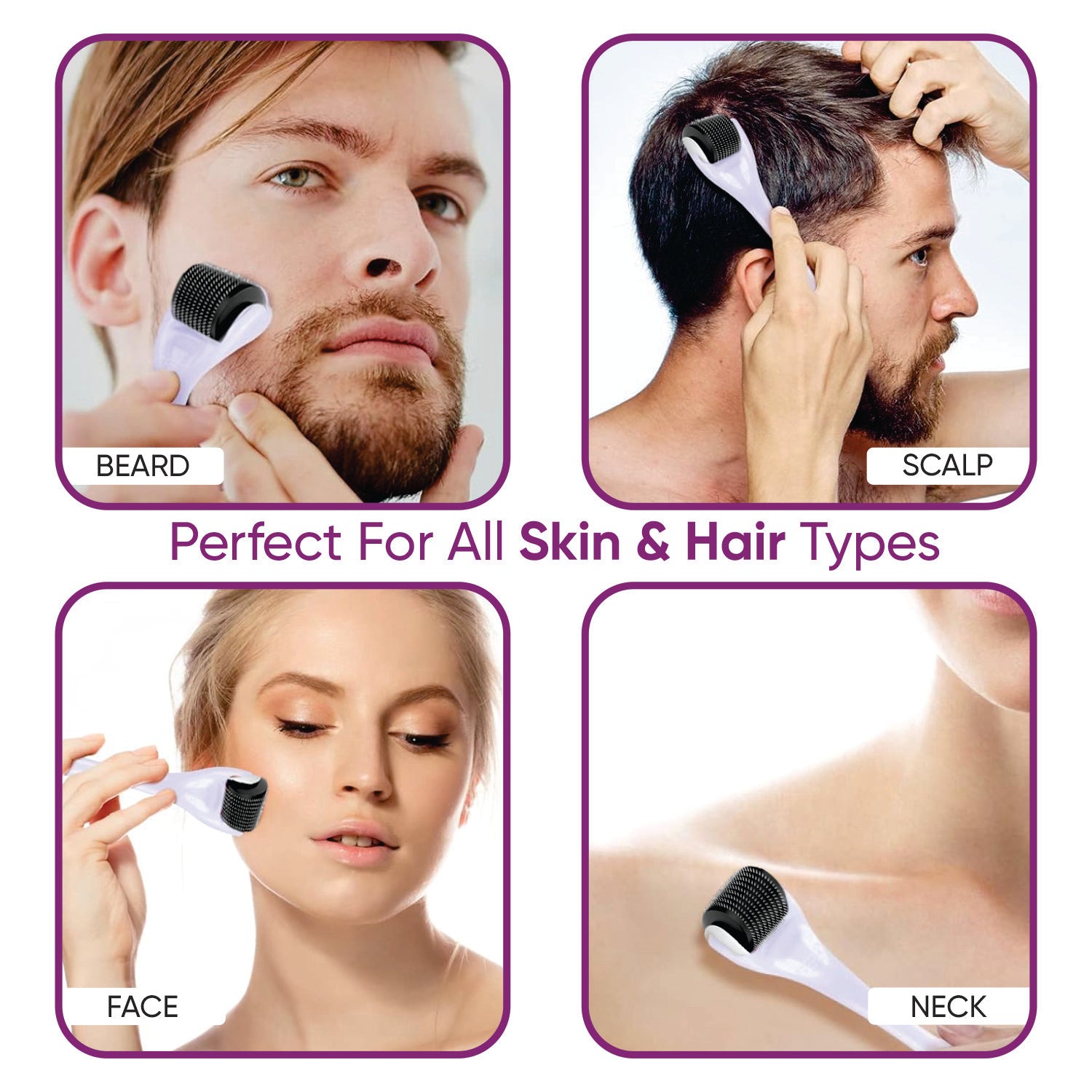 Microneedle roller for hair loss treatment and follicle activation