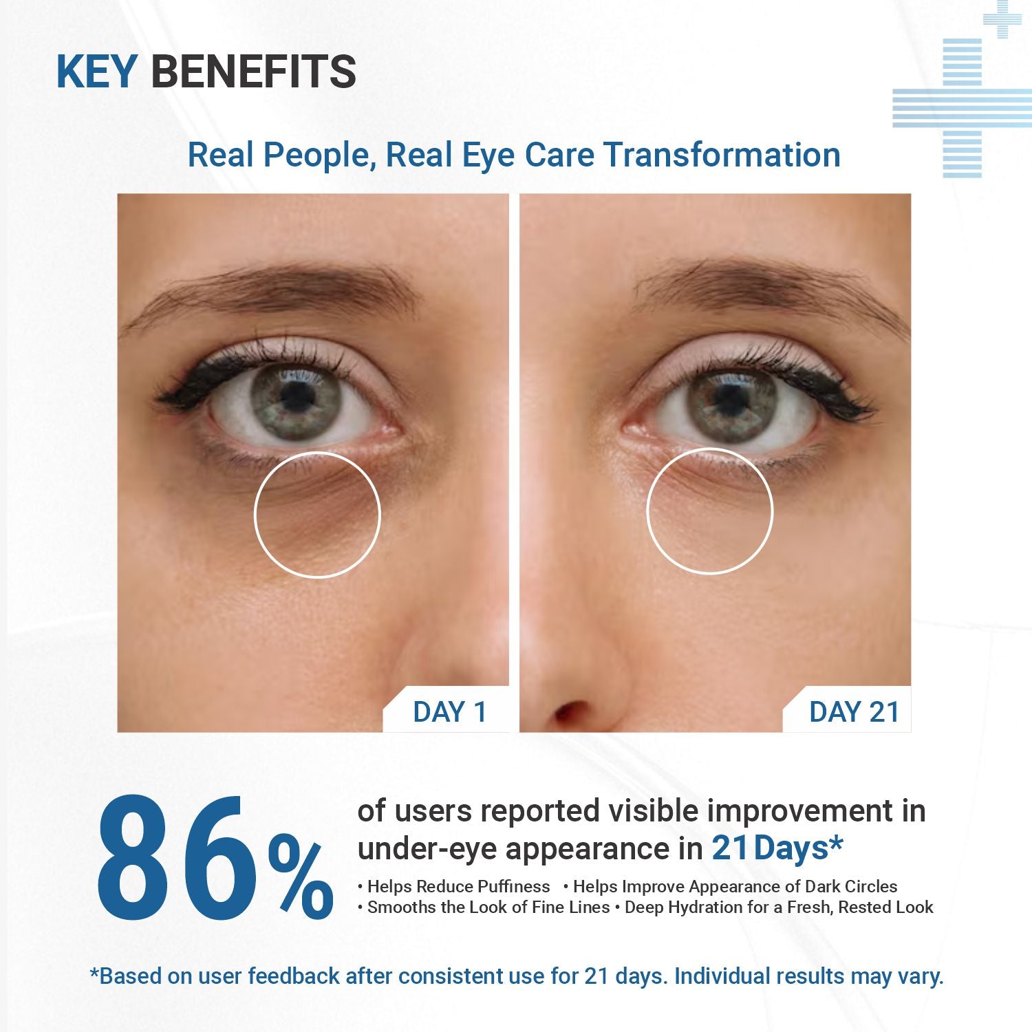 Best Under Eye Cream for Dark Circles in India by Dermasys – Advanced Dark Circle Treatment