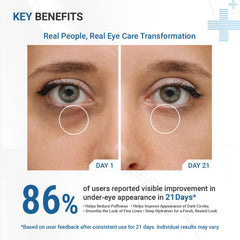 Best Under Eye Cream for Dark Circles in India by Dermasys – Advanced Dark Circle Treatment