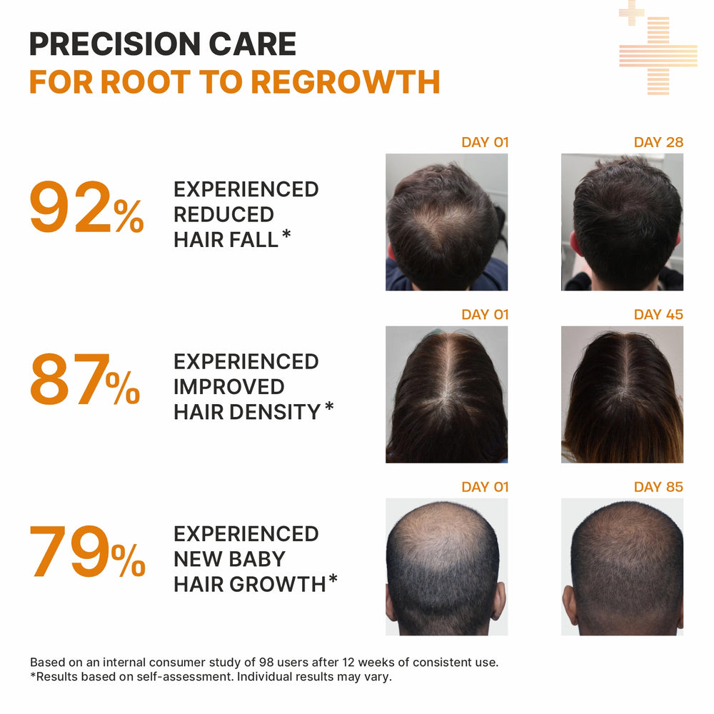 Hair regrowth serum roll on Dermasys for thinning hair and hair loss control